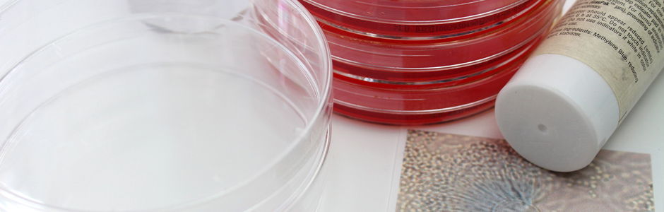 Koruyucu Etkinlik Testi (Challenge Test) 